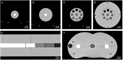 Potential of a Second-Generation Dual-Layer Spectral CT for Dose Calculation in Particle Therapy Treatment Planning